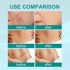 Scar Repair Spray