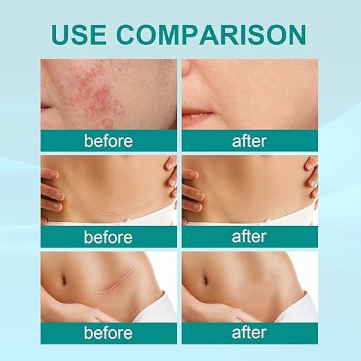Scar Repair Spray